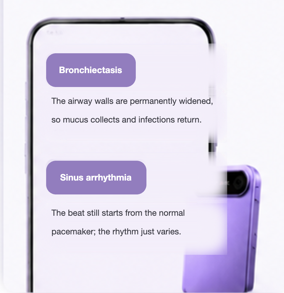 Medical terms explained in one sentence